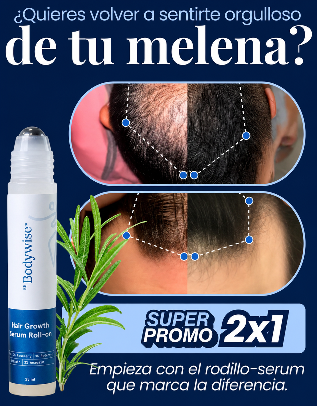 BodyWise Hair Growth – 2 Unidades de 15 ml | Sérum Capilar Roll-on